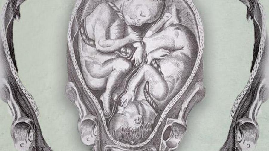 embryo twins